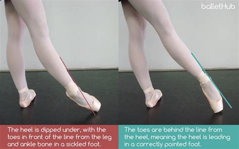 What Is a Sickle Foot in Dance and Its Related Dance Techniques